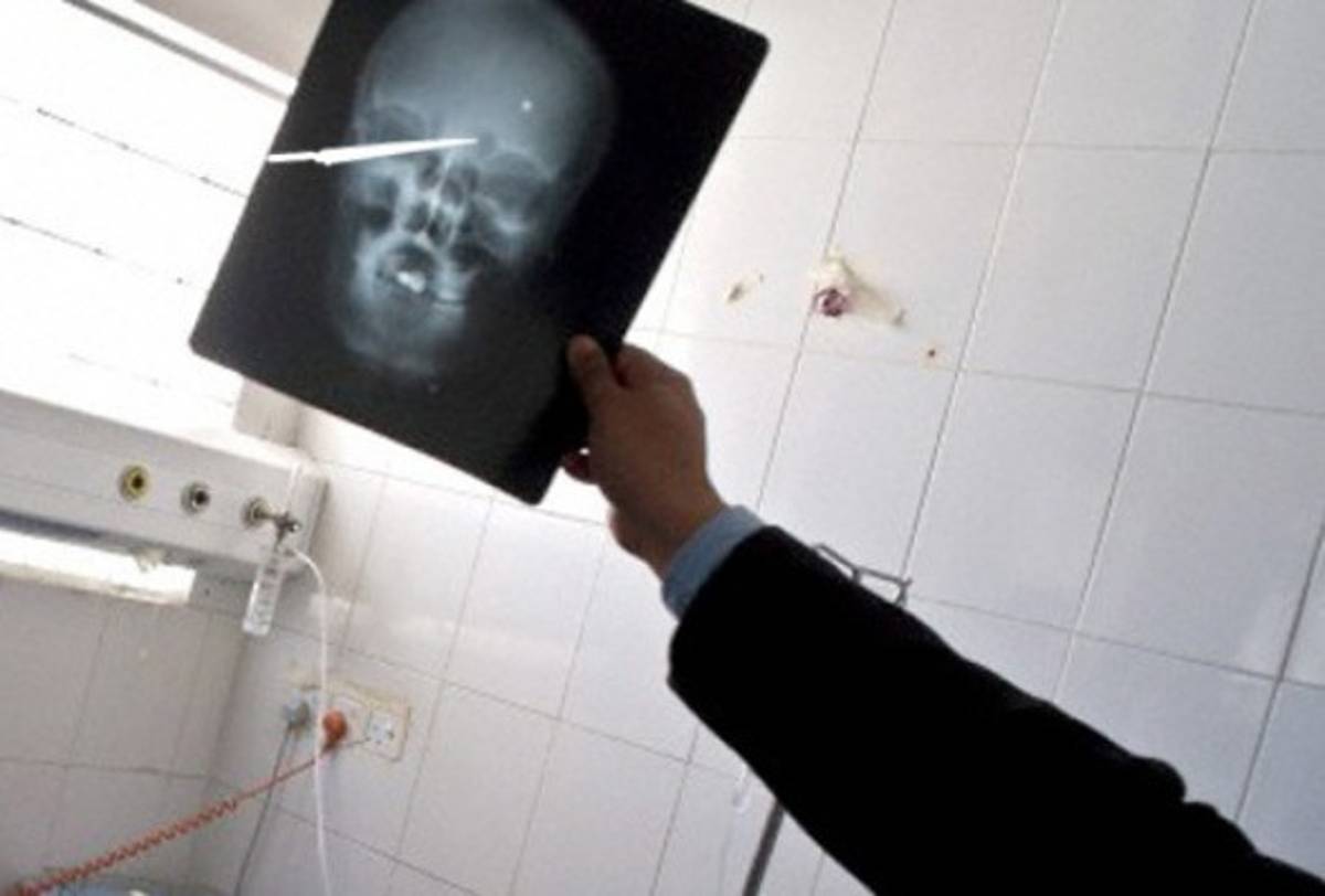 Sobrevive con un puñal