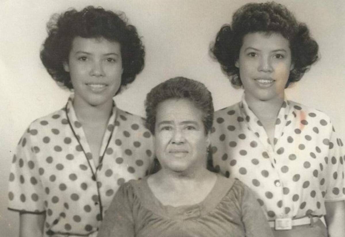 'Fue muy duro separarme de mi hermana gemela'