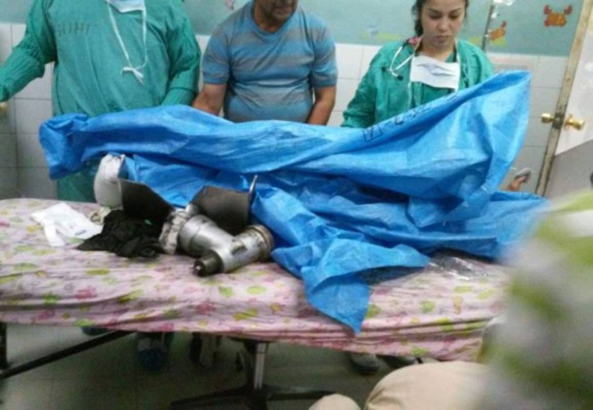 Molino eléctrico casi demuele mano derecha a un menor de edad en Comayagüela