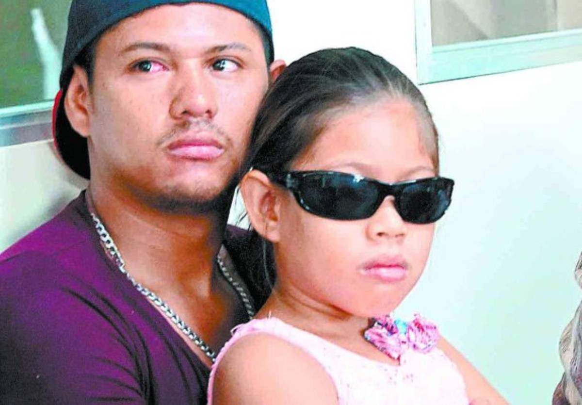 Honduras: En un 60 por ciento aumentan casos de conjuntivitis