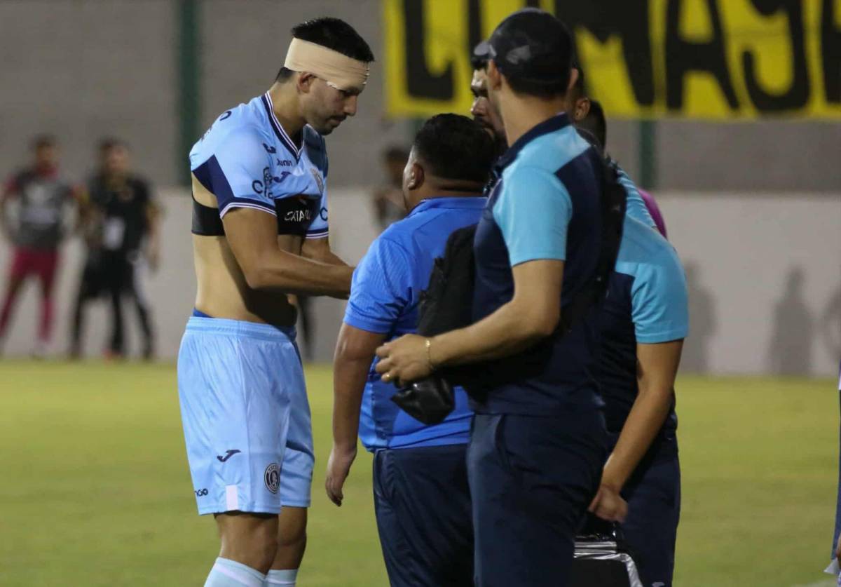 Fotos: Futbolista terminó jugando vendado, tristeza en el Génesis y las bellezas en el estadio