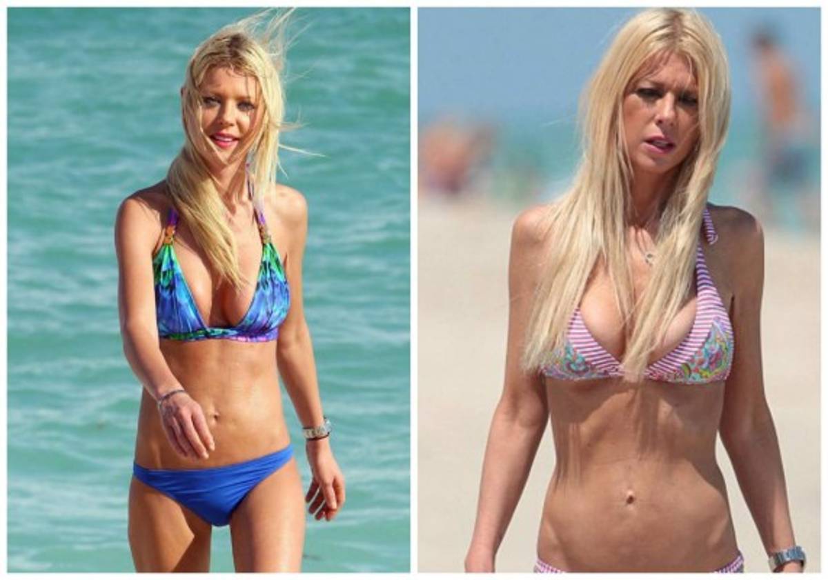 Famosa actriz de Hollywood es víctima de la anorexia