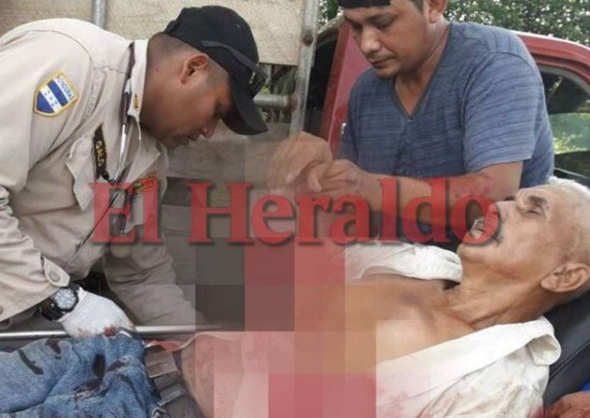 Un muerto y dos menores heridos deja frustrado asalto en El Triunfo, Choluteca