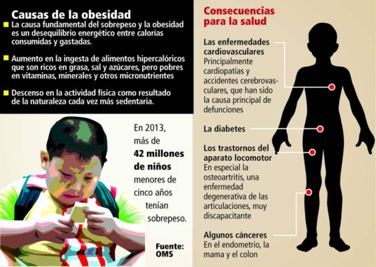 Unos 11 mil niños de cinco años padecen obesidad