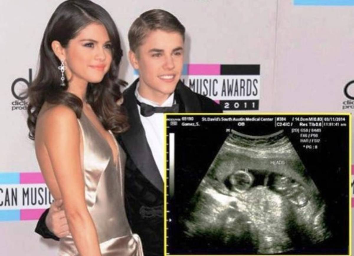 Selena Gomez ¿está embarazada?