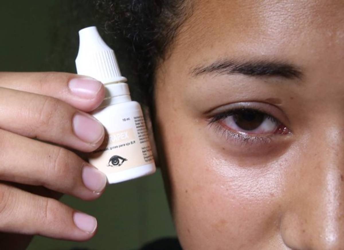 Se triplica consumo de fármacos para conjuntivitis en Honduras