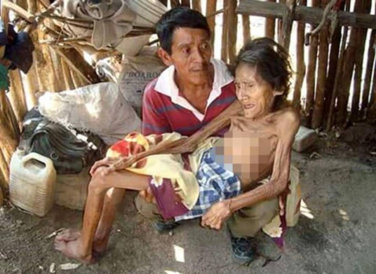 Anciana conmueve a hondureños y recibe ayuda