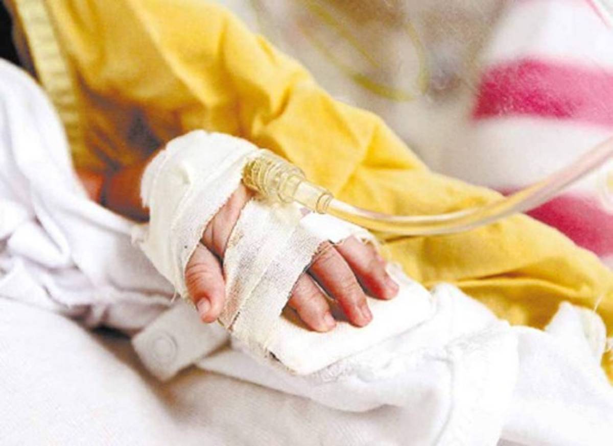 Honduras: Salud reporta 684 casos de hepatitis en lo que va de 2015