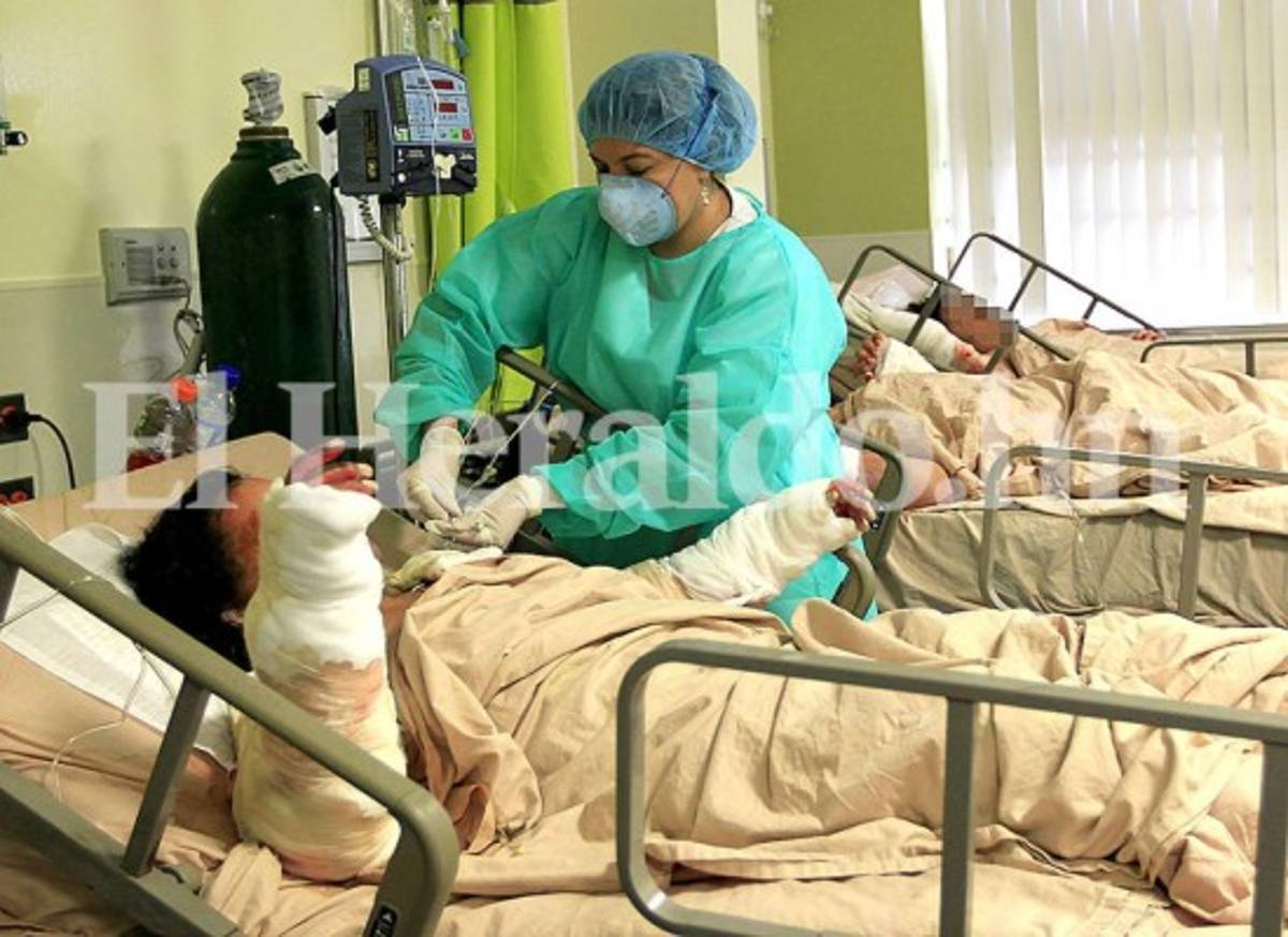 Cinco pacientes quemados en Feria del Agricultor siguen graves