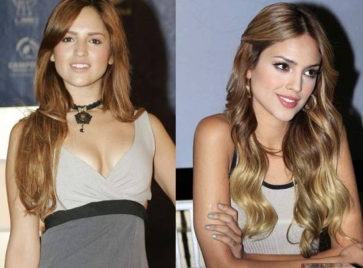 Celebridades que se hicieron 'retoques' en la nariz