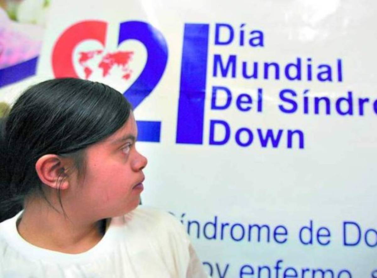 12,400 niños hondureños tienen síndrome de Down