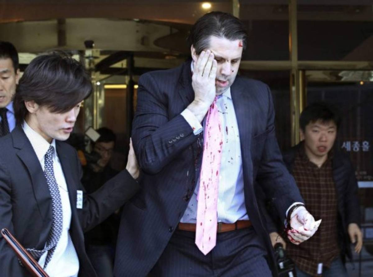 Embajador de EEUU en Seúl, herido con un cuchillo