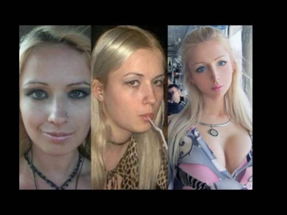 Así lucía la ''Barbie humana'' antes de las cirugías