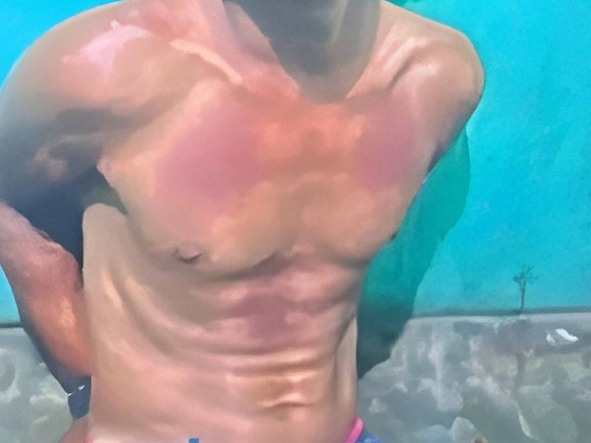 Con salsa de tomate fingió golpes y heridas para exigir pago de rescate a familiares
