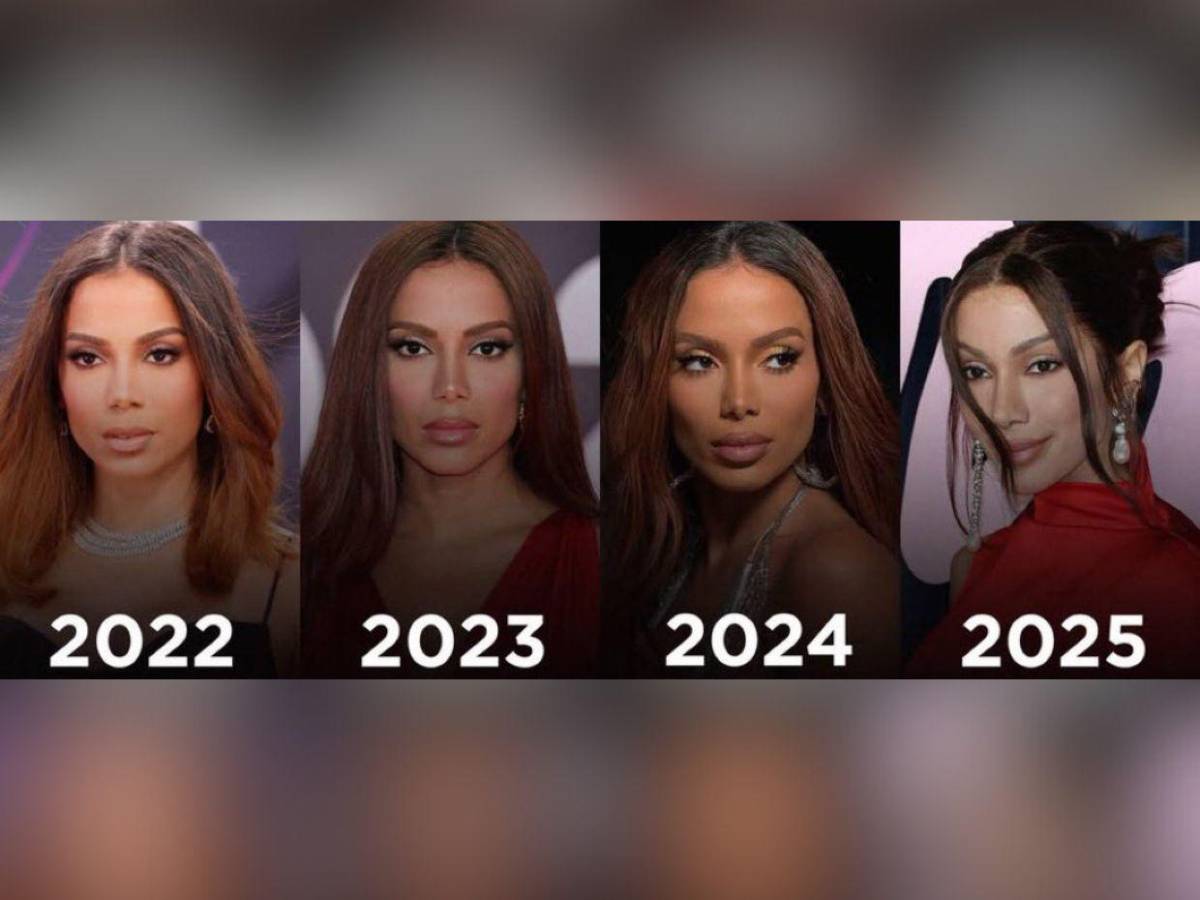 ¿Anitta se sometió a más cirugías? Mi mayor miedo es no reconocerla porque tiene nueva cara