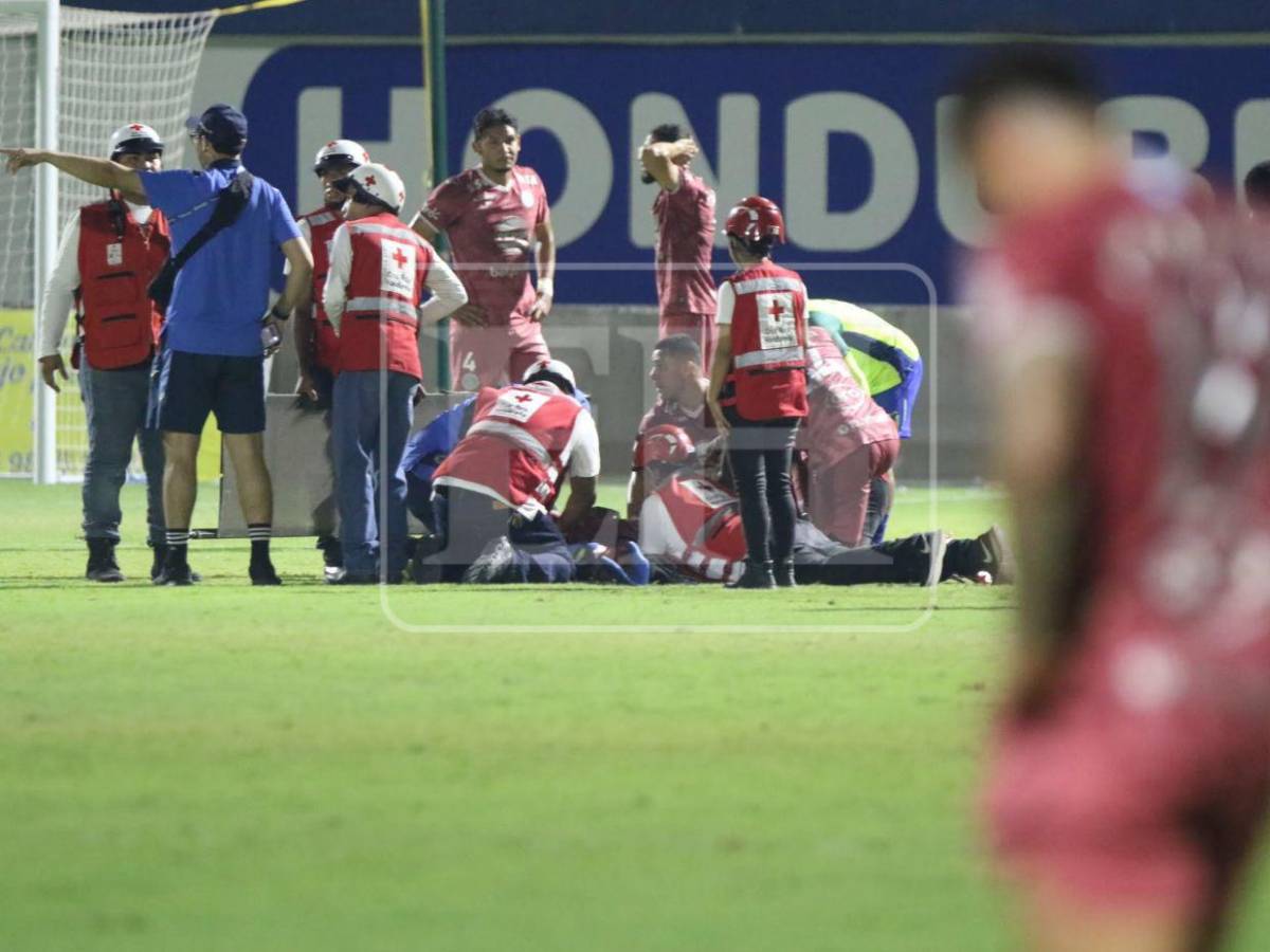 Romario da Silva, futbolista de Motagua, fue intervenido tras su fuerte lesión: ¿volverá a jugar?