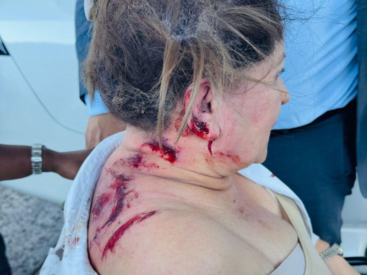 ¿Quiénes son los sospechosos de atacar a la diputada Gladis López con un artefacto explosivo?