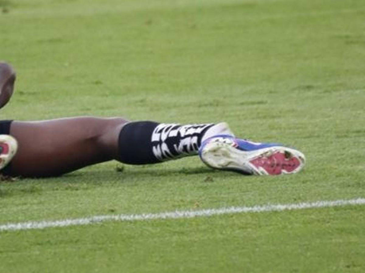 Así fue la espeluznante lesión de tobillo que sufrió Jean Pierre Arroyo