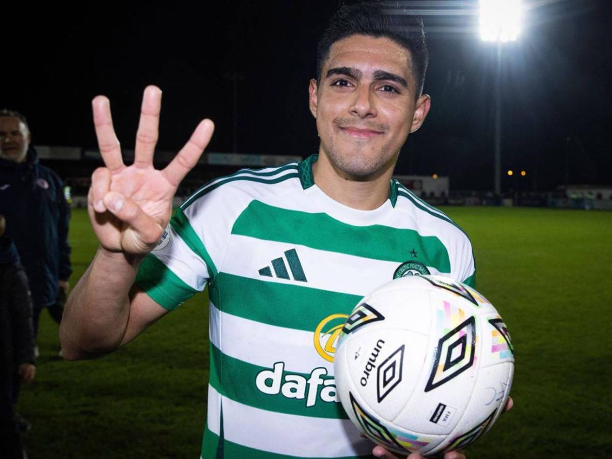 Luis Palma revela por qué bajó su nivel y salió del Celtic: Estuve con un psicólogo