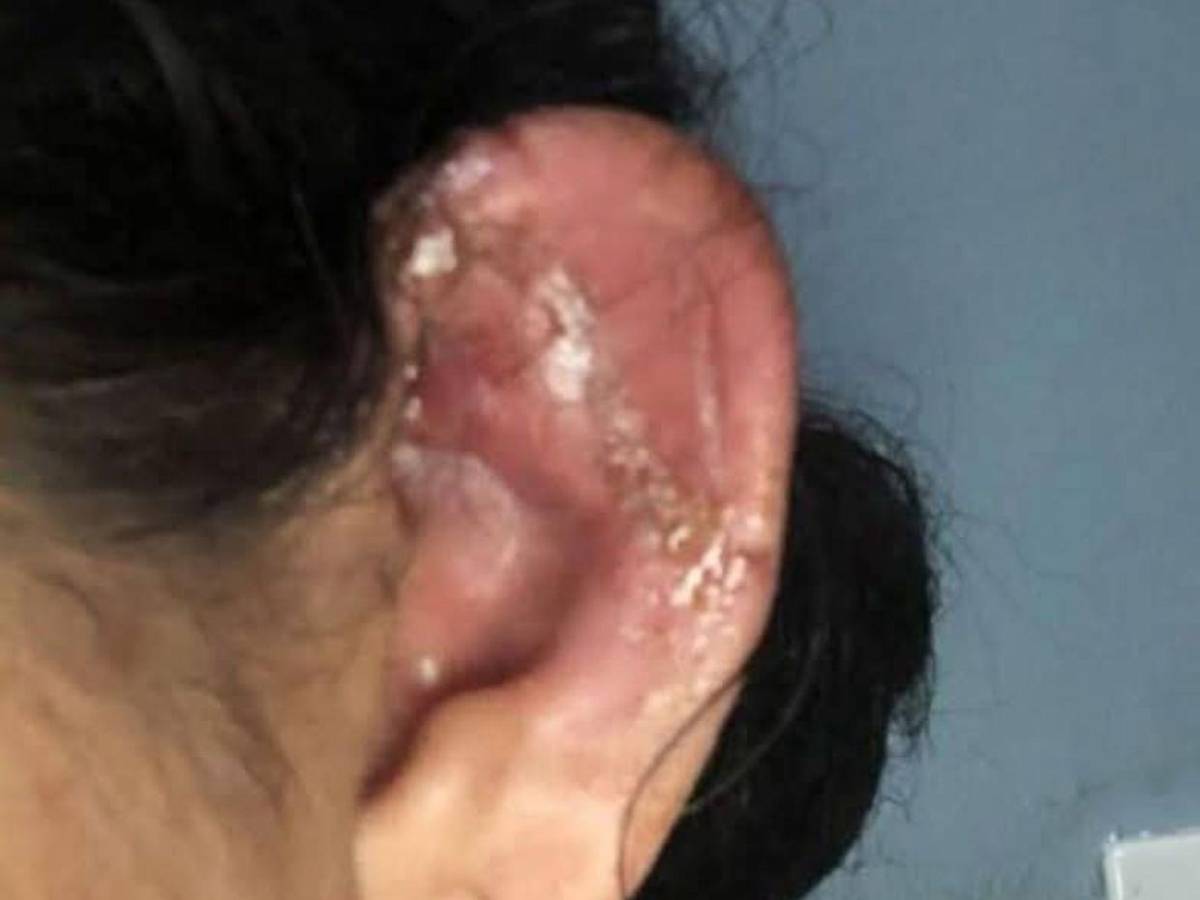 Golpes y mordidas: mujer fue salvajemente atacada por su pareja en Olancho