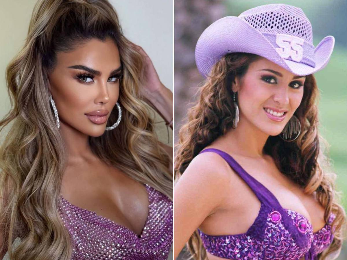 ¿Qué más se hará Ninel Conde? La actriz revela su próximo arreglo estético