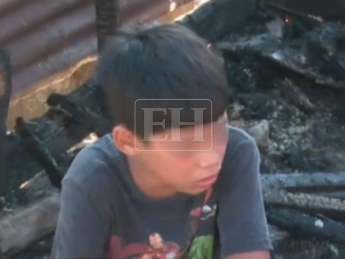 Dios ya lo había salvado: Niño fallecido en incendio en SPS había superado dos cirugías