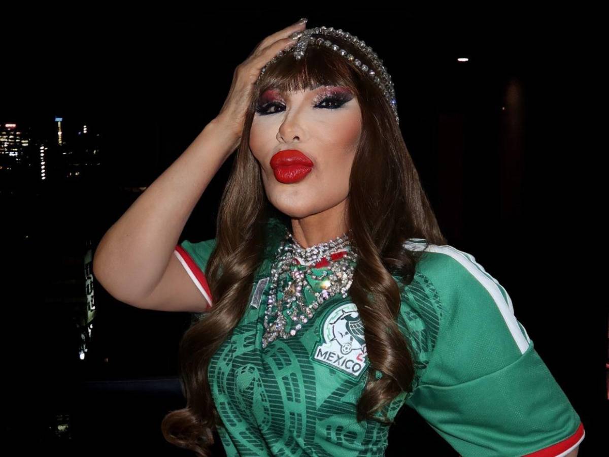 Lyn May y el error estético que deformó su rostro