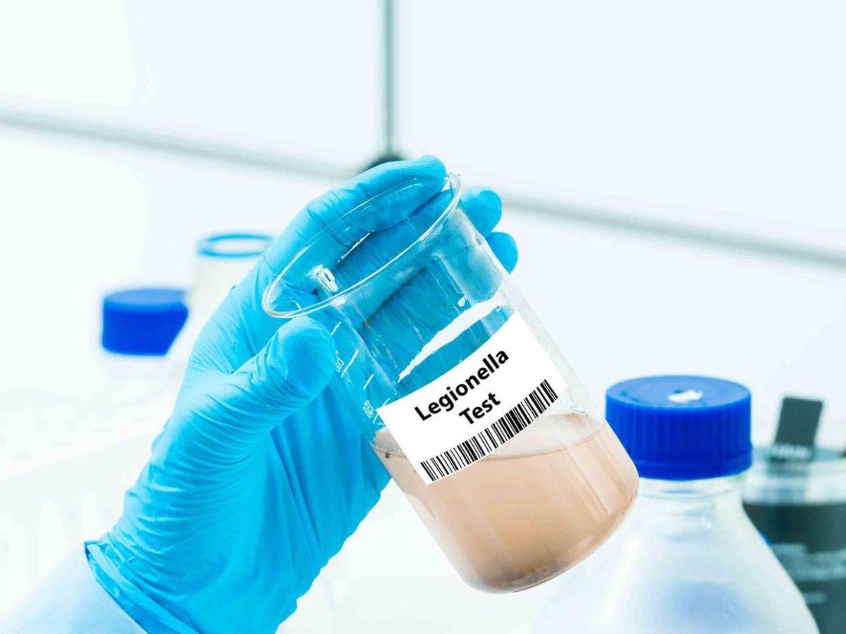 Legionelosis: Síntomas y tratamiento de la enfermedad que preocupa a Nueva York