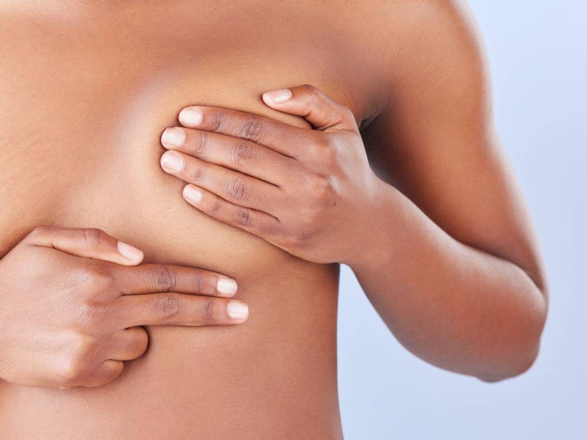 Cáncer de mama: síntomas, causas y cómo prevenirlo, según los CDC