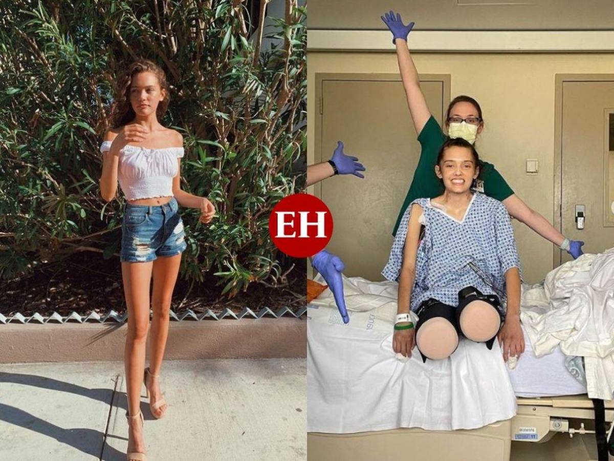 La modelo Carolyn Bridges perdió ambas piernas por complicaciones de covid-19