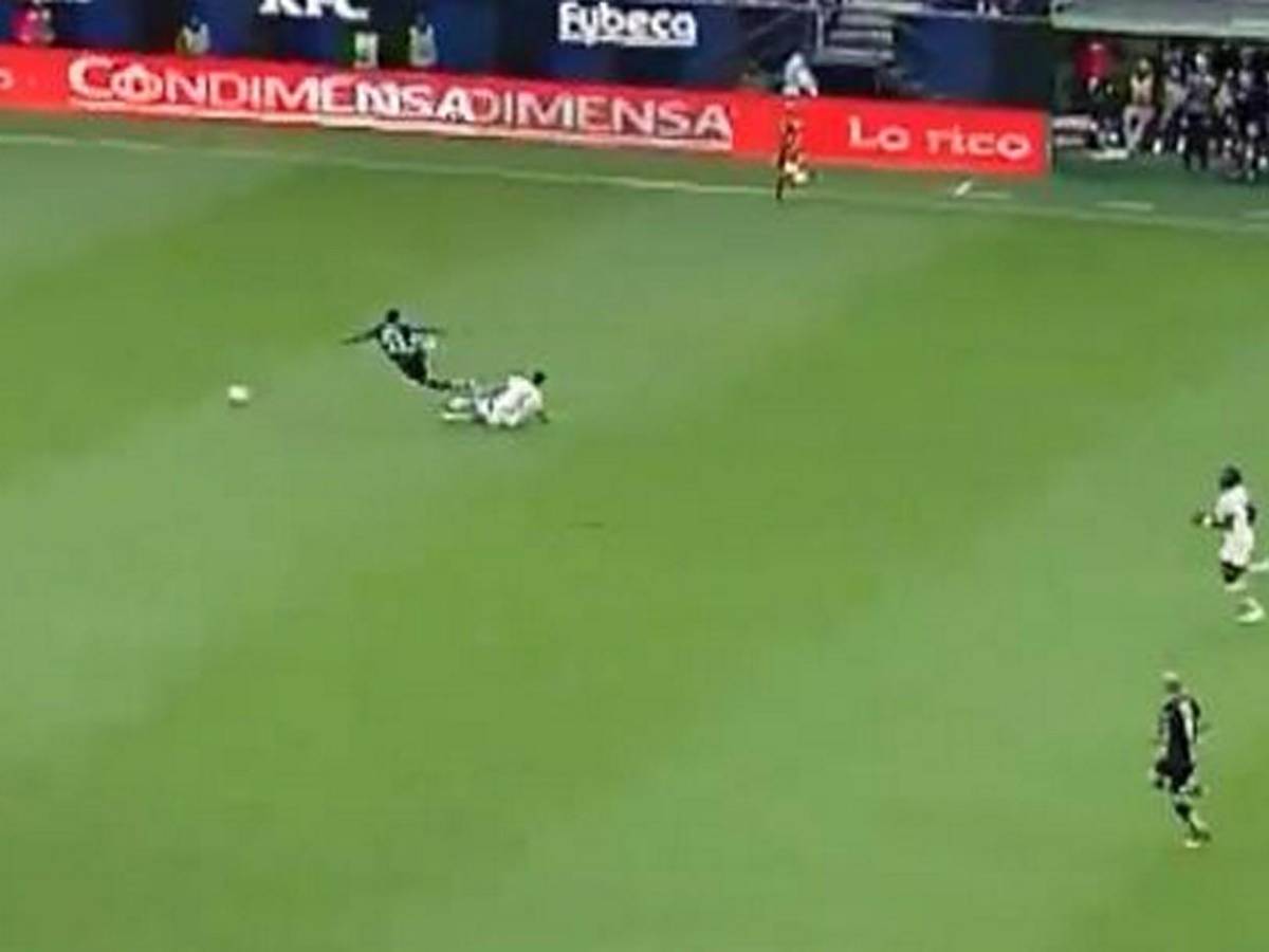 Así fue la espeluznante lesión de tobillo que sufrió Jean Pierre Arroyo