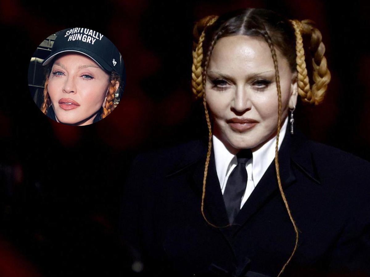 “Mira lo linda que estoy ahora...”: Madonna admite nueva cirugía plástica