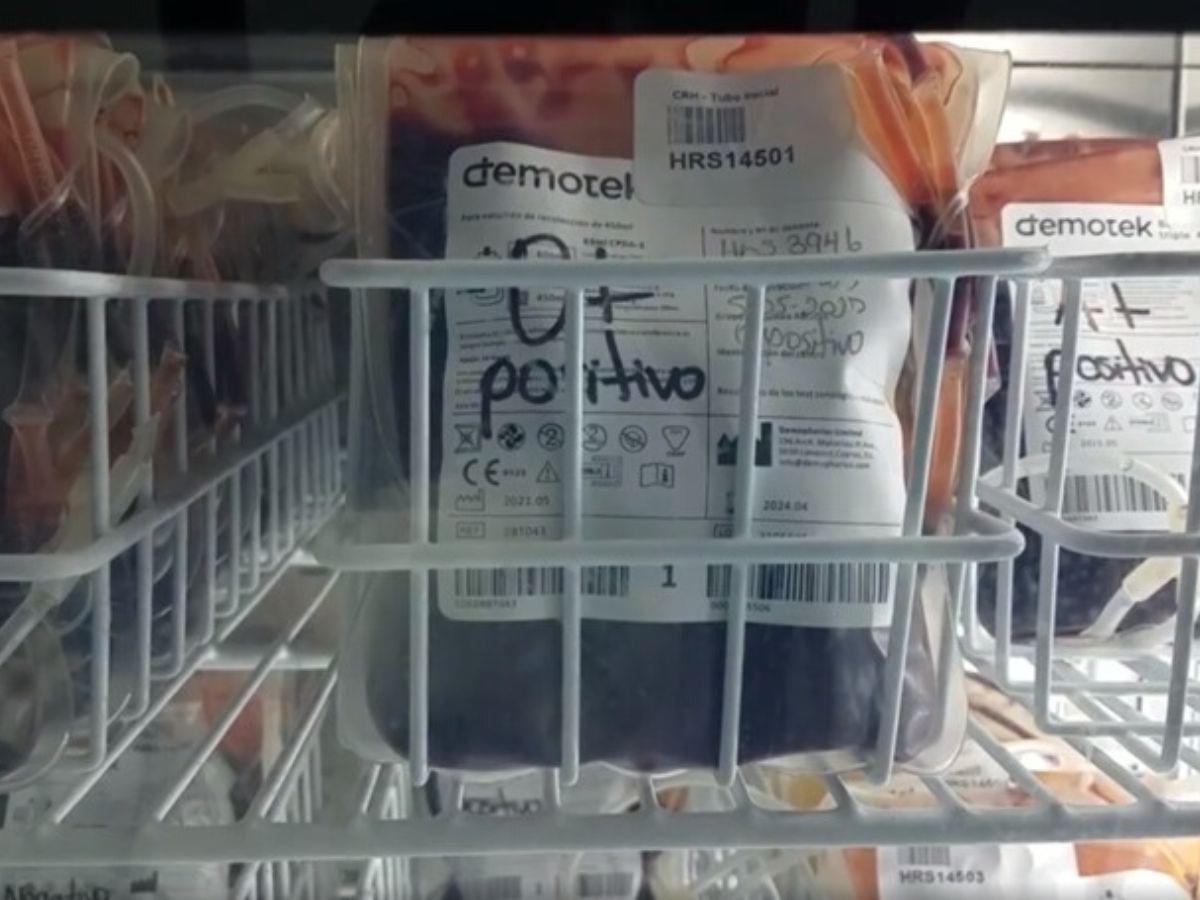 Abastecido el banco de Sangre del Hospital del Sur