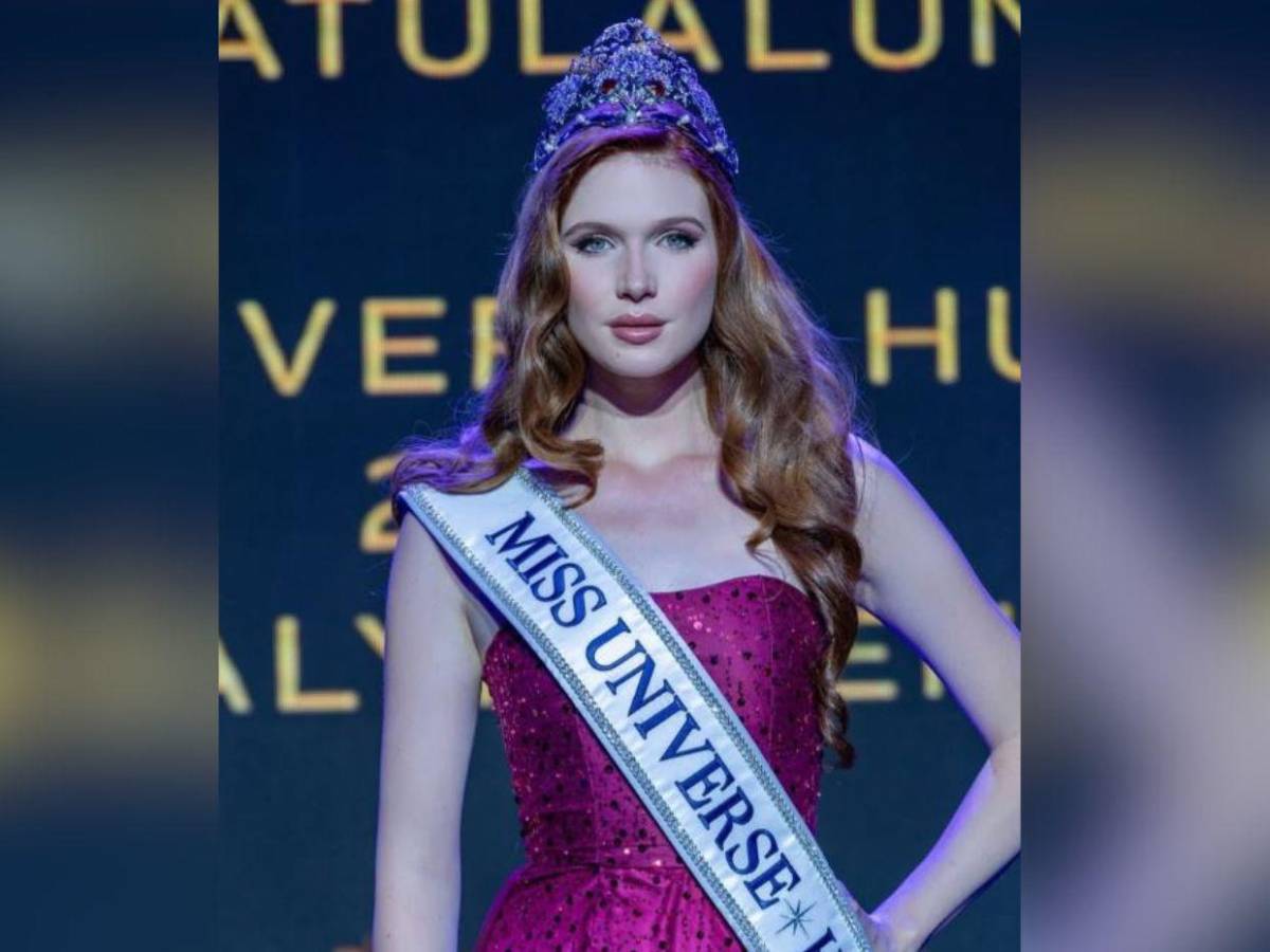 Miss Honduras Universo y siete reinas más sufren intoxicación alimentaria