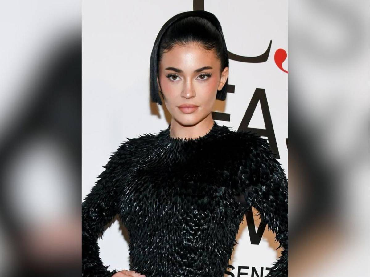 ¿Cambio de cara? Las famosas que han abusado de las cirugías estéticas