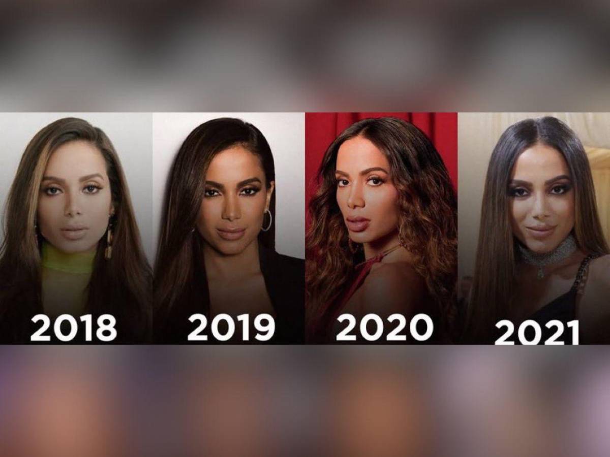¿Anitta se sometió a más cirugías? Mi mayor miedo es no reconocerla porque tiene nueva cara