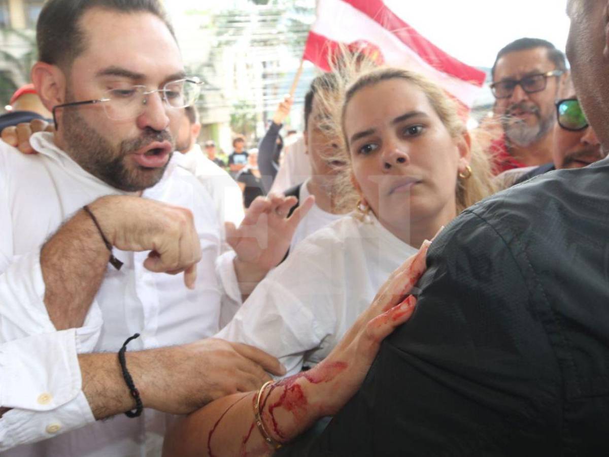 En fotos: así fue la agresión de policías y seguridad privada hacia liberales en el Congreso