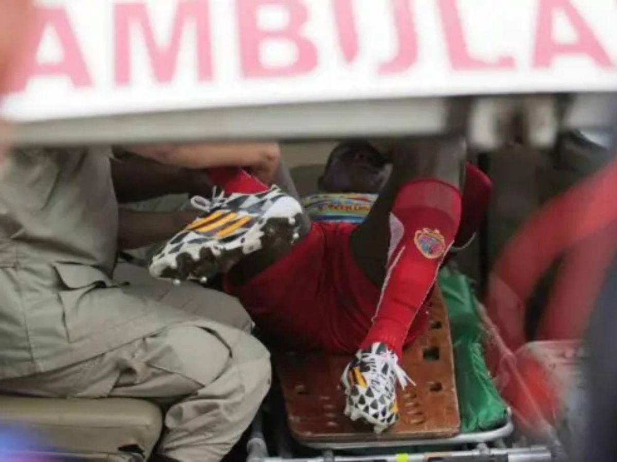 Las lesiones más escalofriantes que han ocurrido en el fútbol hondureño