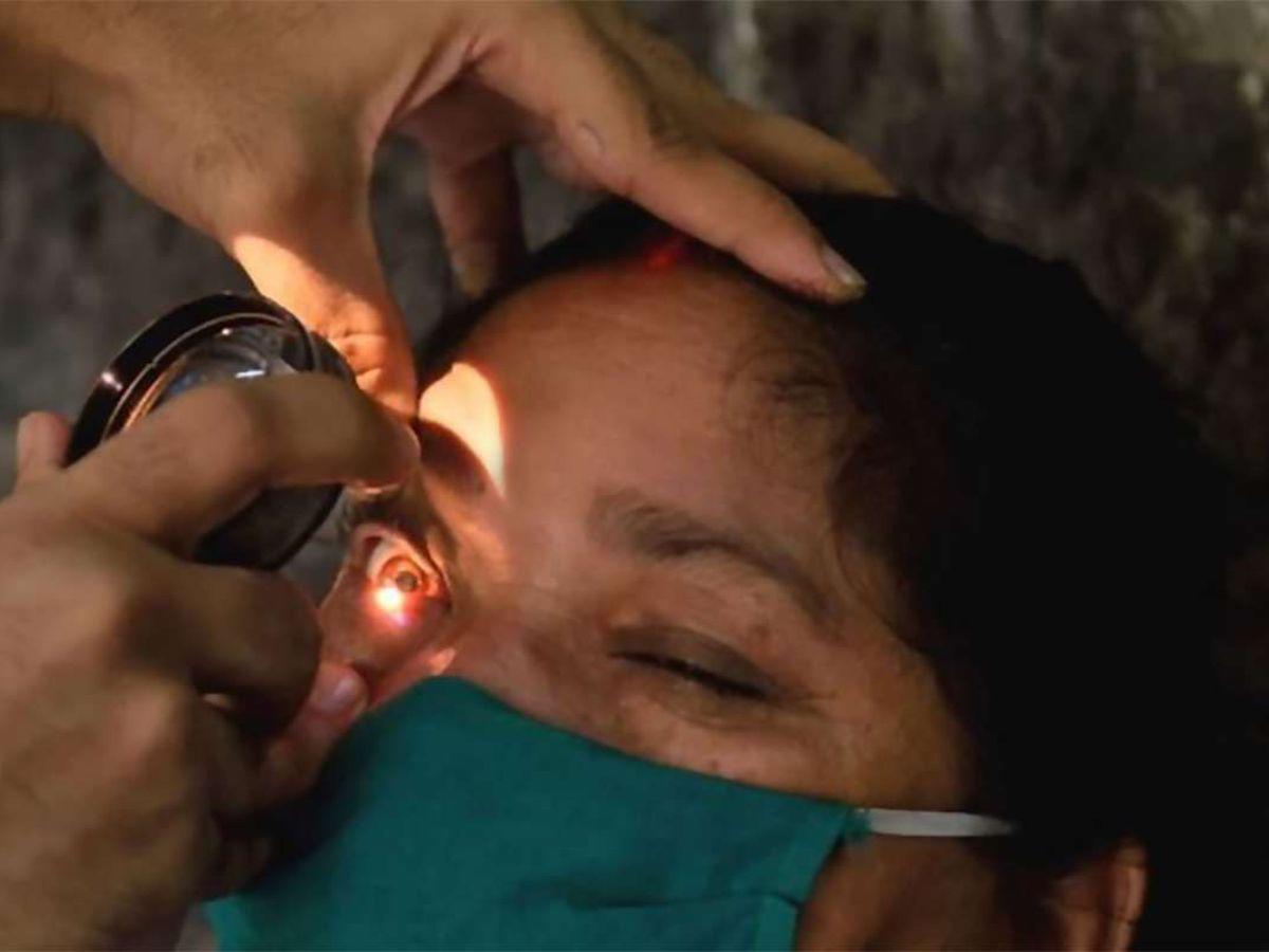 Personas que se infectan de Hongo Negro tienen una probabilidad del 70% de morir