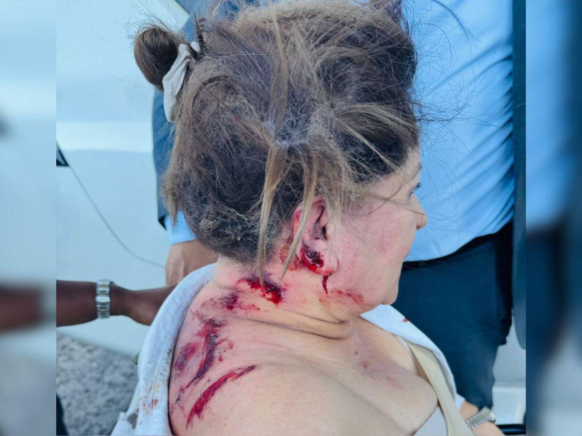 Lo que informa el 911 sobre el ataque con explosivo a diputada Gladis Aurora López