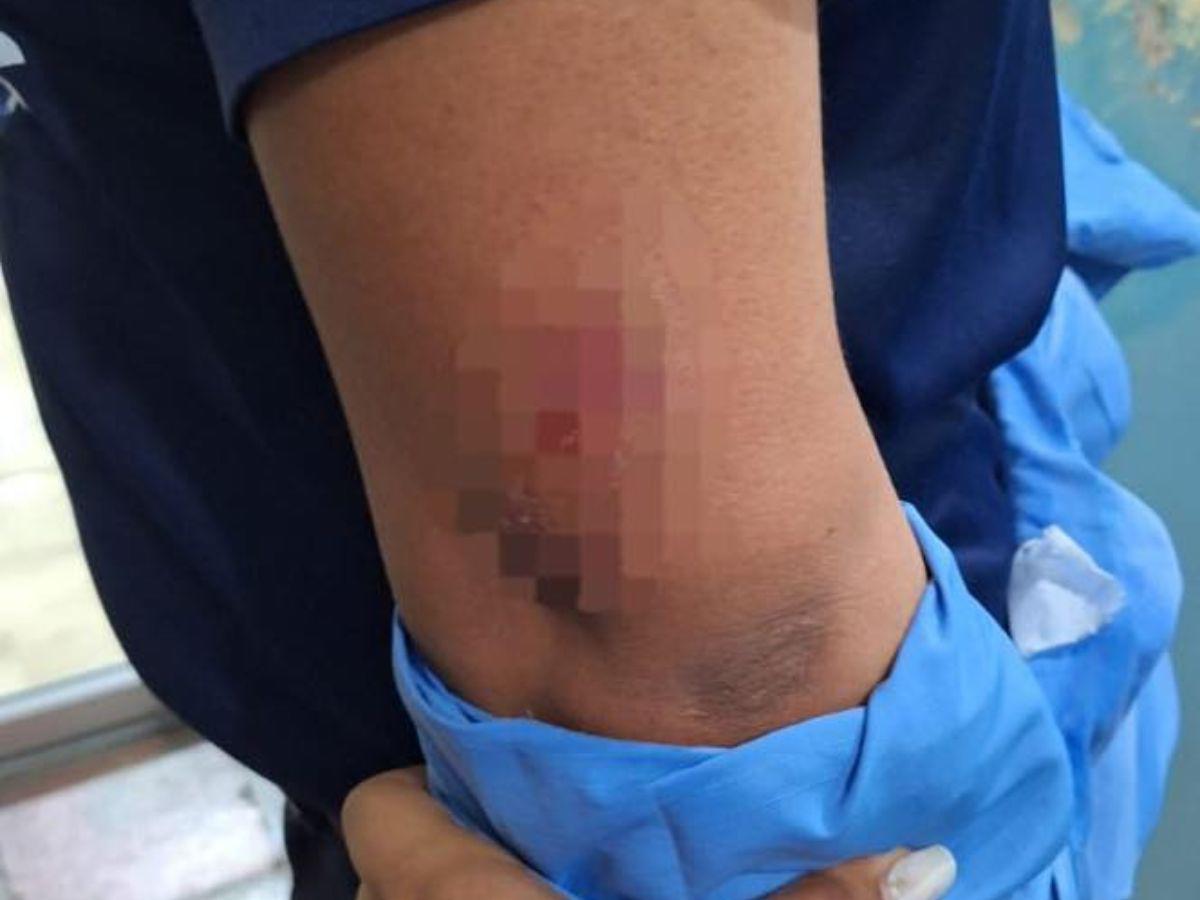 Momento en el que atacan a policías durante el arresto de una mujer en San Lorenzo: hay tres detenidos