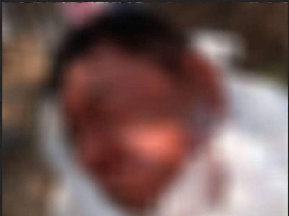 “Faltan 3 por matar”: hallan cabeza humana en Yoro y la Policía busca el resto del cuerpo
