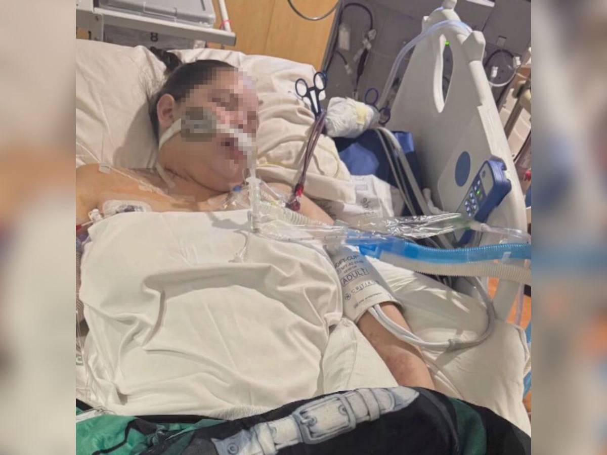 Kaydin Ruiz, la adolescente que perdió dos piernas y un brazo tras complicaciones por gripe en Texas
