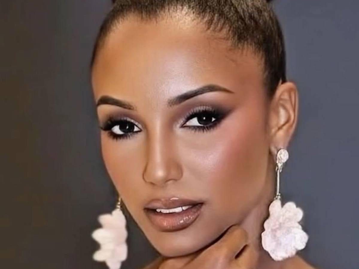 Miss Jamaica: Su estado empeora tras caída en Miss Universo 2025