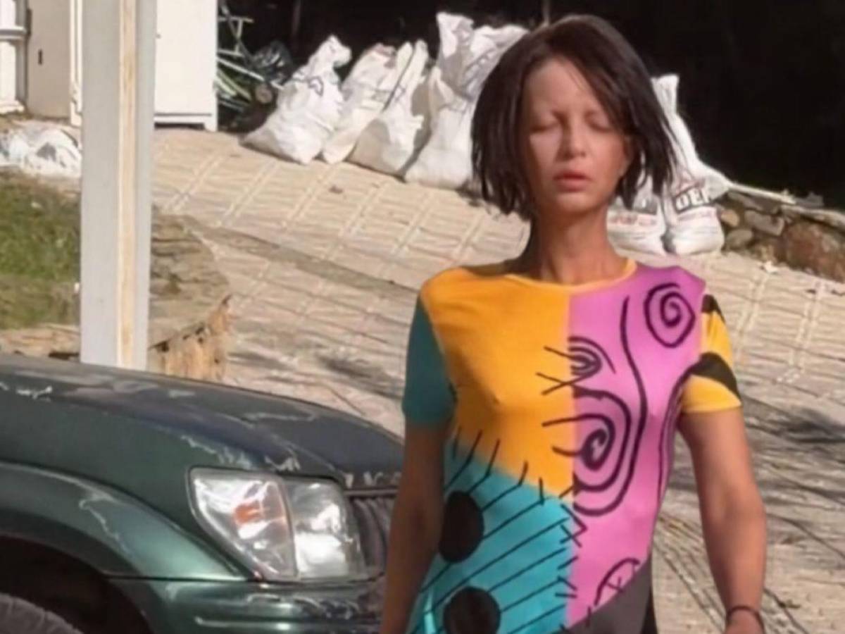 Hija trans de Camilo Sesto ingresa grave a hospital: esto se sabe