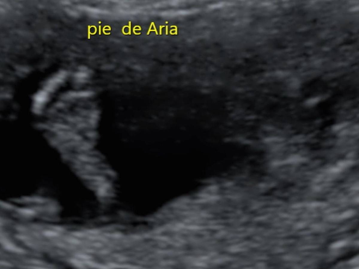 Ana Brenda Contreras revela el sexo y nombre de su bebé