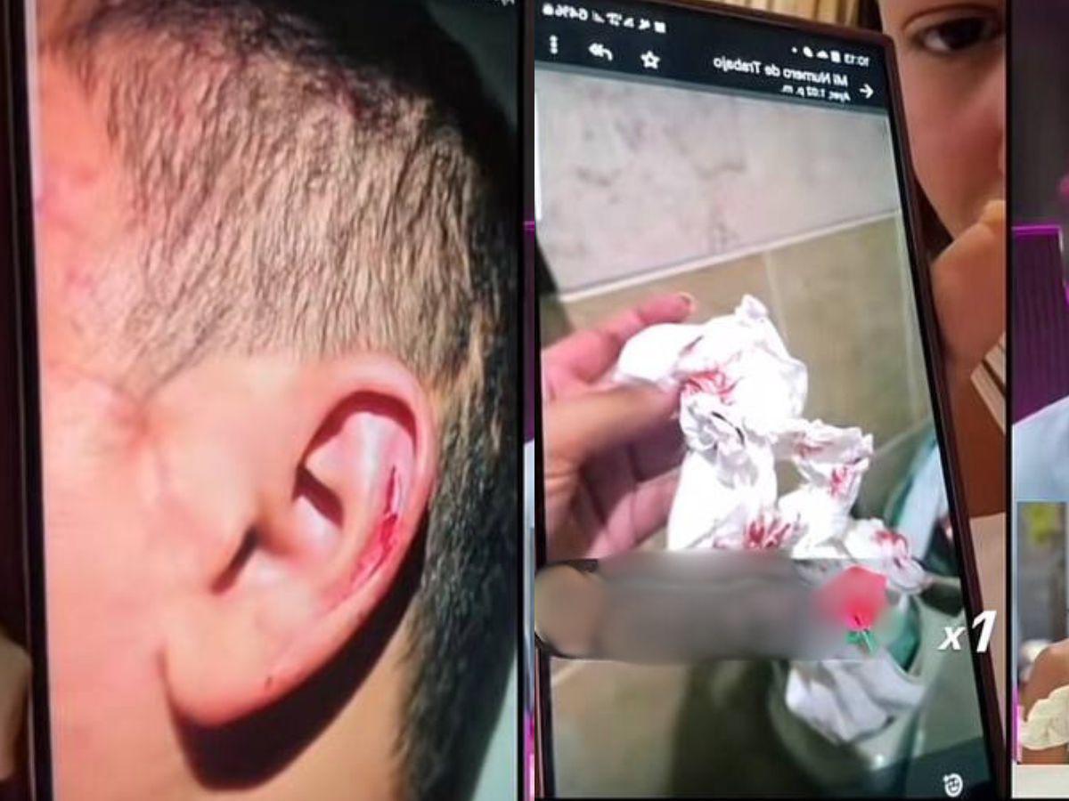 Encima de mí caía la sangre: Alejandra Rubio expone fotos de Javian Thompson agrediéndose por celos