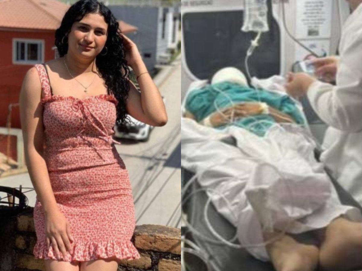 Tiene una hemorragia pulmonar: Nelsy López, la joven que se cayó de la rueda de Chicago en Copán