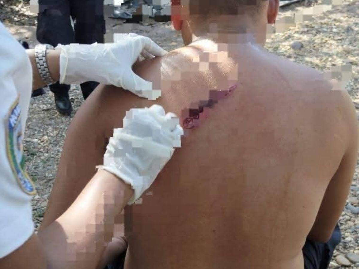 “¡Nos están emboscando, son dos carros!”: Revelan momentos de terror que vivieron policías en Colón