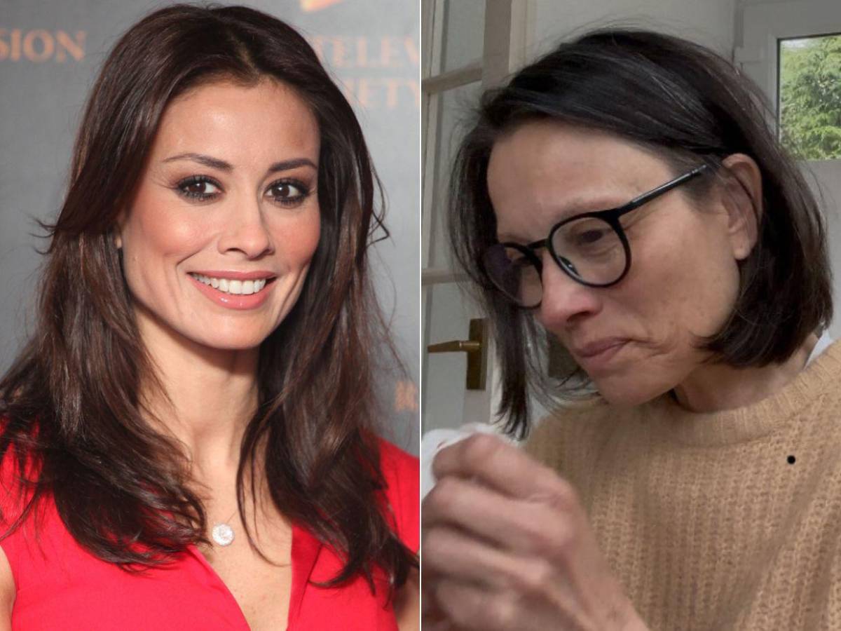 Exmodelo Melanie Sykes, casi calva: enfermedad autoinmune le destruyó el cabello